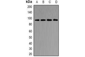 Western blot analysis of CD2AP expression in MCF7 (A), SW480 (B), mouse kidney (C), rat kidney (D) whole cell lysates. (CD2AP Antikörper)