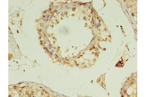 Immunohistochemistry of paraffin-embedded human testis tissue using ABIN7150974 at dilution of 1:100 (RANBP2 Antikörper  (AA 2601-2802))