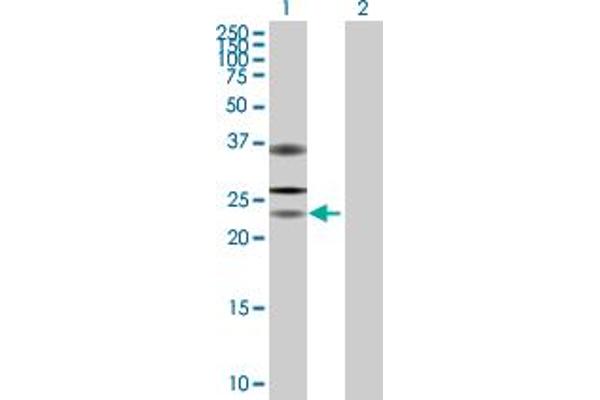 USP53 Antikörper  (AA 1-188)