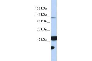 WB Suggested Anti-MLH3 Antibody Titration:  0. (MLH3 Antikörper  (Middle Region))