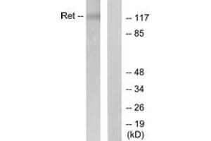 Western blot analysis of extracts from K562 cells, using Ret (Ab-1062) Antibody. (Ret Proto-Oncogene Antikörper  (AA 1041-1090))