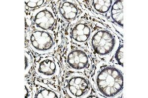 Immunohistochemistry of paraffin-embedded human colon using Tec Rabbit pAb (ABIN6128353, ABIN6148988, ABIN6148989 and ABIN6213654) at dilution of 1:100 (40x lens). (NR4A3 Antikörper  (AA 1-280))