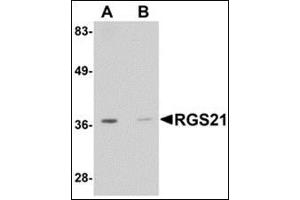 Western blot analysis: AP30716PU-N RGS21 antibody staining of HepG2 cell lysate at 0. (RGS21 Antikörper  (Center))