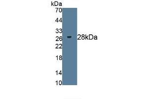 Detection of Recombinant HSPG2, Mouse using Polyclonal Antibody to Heparan Sulfate Proteoglycan 2 (HSPG2) (HSPG2 Antikörper)