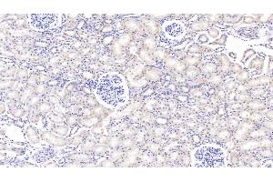 Detection of PIGR in Bovine Kidney Tissue using Polyclonal Antibody to Polymeric Immunoglobulin Receptor (PIGR) (PIGR Antikörper  (AA 461-560))