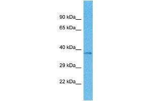 Western Blotting (WB) image for anti-Olfactory Receptor, Family 4, Subfamily M, Member 1 (OR4M1) (C-Term) antibody (ABIN2774564) (OR4M1 Antikörper  (C-Term))