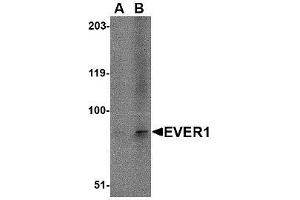 Western blot analysis of EVER1 in A-20 cell lysate with AP30321PU-N EVER1 antibody at (A) 1 and (B) 2 μg/ml. (TMC6 Antikörper  (N-Term))