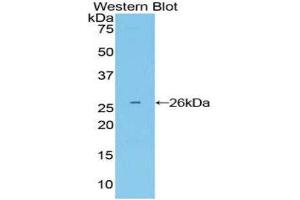Western Blotting (WB) image for anti-Growth Factor Receptor-Bound Protein 7 (GRB7) (AA 298-489) antibody (ABIN1859066)