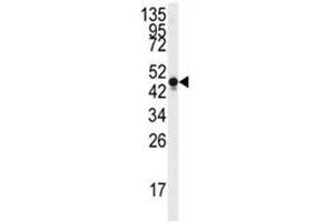 Western blot analysis of Neuron Specific Enolase antibody and Y79 lysate.