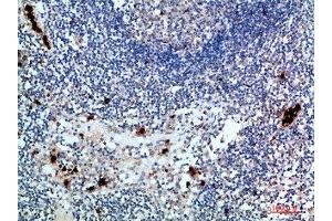 Immunohistochemical analysis of paraffin-embedded human-lymph, antibody was diluted at 1:200 (ZAP7 (AA 391-440) Antikörper)