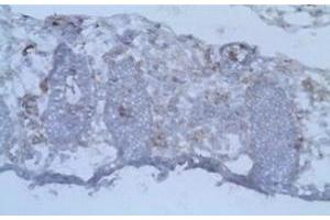 Immunohistochemistry (IHC) image for anti-CD40 Ligand (CD40LG) antibody (ABIN1105904) (CD40 Ligand Antikörper)
