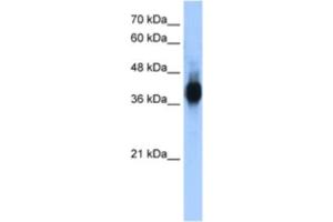 Western Blotting (WB) image for anti-LIM Domain Binding 1 (LDB1) antibody (ABIN2461587) (LIM Domain Binding 1 Protein Antikörper)