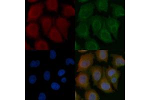 MURC Mouse Monoclonal Antibody staining Hela cells by IF/ICC. (MURC Antikörper)