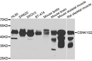 Western blot analysis of extracts of various cell lines, using CSNK1G2 antibody. (Casein Kinase 1 gamma 2 Antikörper)
