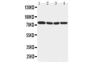 Anti-IRAK antibody, Western blotting Lane 1: Rat Liver Tissue Lysate Lane 2: Human Placenta Tissue Lysate Lane 3: MCF-7 Cell Lysate Lane 4: PANC Cell Lysate (IRAK1 Antikörper  (N-Term))
