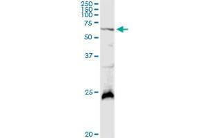 GALNT4 MaxPab rabbit polyclonal antibody. (GALNT4 Antikörper  (AA 1-578))