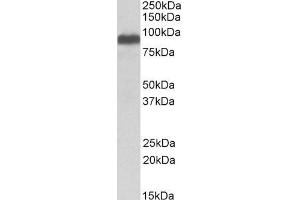 ABIN334426 (0. (ITCH Antikörper  (Internal Region))