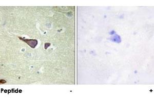 Immunohistochemical analysis of paraffin-embedded human brain tissue using IGF2R polyclonal antibody .