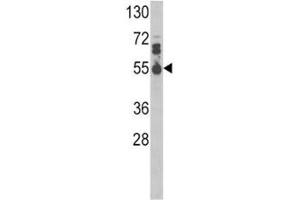 Western blot analysis of IL17RB antibody and MDA-MB468 lysate. (IL17 Receptor B Antikörper  (AA 207-234))