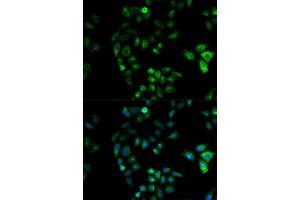 Immunofluorescence (IF) image for anti-Hydroxysteroid (17-Beta) Dehydrogenase 2 (HSD17B2) antibody (ABIN1873085) (HSD17B2 Antikörper)