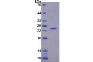 SDS-PAGE analysis of Human TNNI1 Protein.