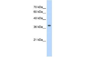 WB Suggested Anti-TPM1 Antibody Titration:  1. (Tropomyosin Antikörper  (N-Term))