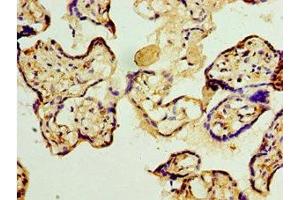 Immunohistochemistry of paraffin-embedded human placenta tissue using ABIN7159637 at dilution of 1:100 (TET2 Antikörper  (AA 1833-2002))