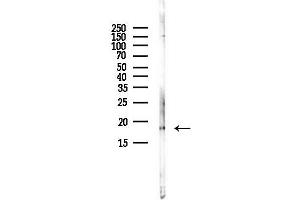 anti-ORM1-Like 3 (ORMDL3) antibody