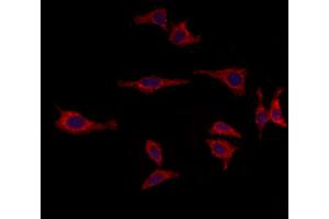 ABIN6264825 and ABIN6273015 staining HepG2 by IF/ICC. (RPGRIP1L Antikörper  (N-Term))