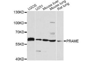 Western blot analysis of extracts of various cell lines, using PRAME antibody. (PRAME Antikörper)