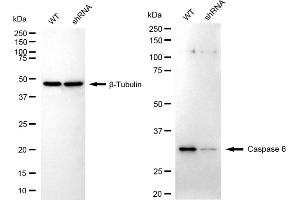 Western blotting analysis using caspase 6 antibody (ABIN7797900).