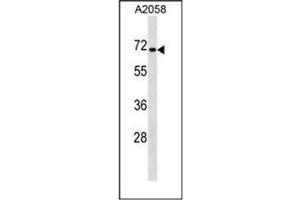 Western blot analysis of CPEB1 Antibody (C-term) in A2058 cell line lysates (35ug/lane).