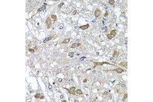Immunohistochemistry of paraffin-embedded rat brain using OSGEPL1 antibody at dilution of 1:100 (x40 lens). (OSGEPL1 Antikörper)