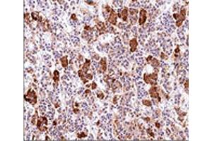 IHC testing of human pituitary gland stained with ACTH antibody (AH26).