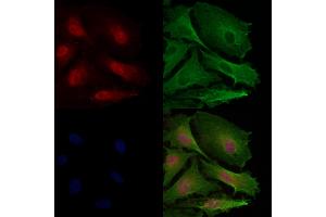 SGK1 Antibody staining A549 cells by IF/ICC.