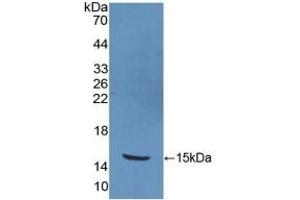Detection of Recombinant PKIb, Human using Polyclonal Antibody to Protein Kinase Inhibitor Beta (PKIb)