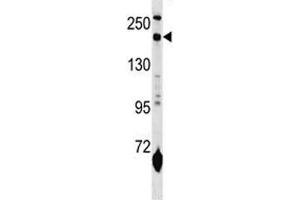 MRC1L1 antibody western blot analysis in mouse lung tissue lysate (Macrophage Mannose Receptor 1 Antikörper  (AA 359-388))