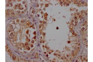 IHC image of ABIN7127446 diluted at 1:100 and staining in paraffin-embedded human testis tissue performed on a Leica BondTM system. (Rekombinanter CYP17A1 Antikörper)
