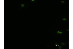 Immunofluorescence of monoclonal antibody to PTBP2 on HeLa cell. (PTBP2 Antikörper  (AA 35-175))