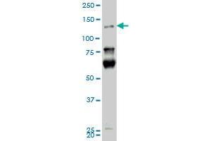 HIPK2 monoclonal antibody (M01), clone 4F4.