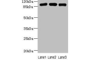 Western blot All lanes: ASAP3 antibody at 1 μg/mL Lane 1: A549 whole cell lysate Lane 2: MCF-7 whole cell lysate Lane 3: K562 whole cell lysate Secondary Goat polyclonal to rabbit IgG at 1/10000 dilution Predicted band size: 100, 44, 98 kDa Observed band size: 100 kDa (ASAP3 Antikörper  (AA 451-700))