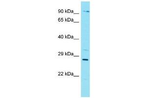 Host:  Rabbit  Target Name:  Nkx3-1  Sample Type:  Mouse Lung lysates  Antibody Dilution:  1. (NKX3-1 Antikörper  (Middle Region))