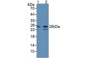 Figure. (CBFB Antikörper  (AA 1-182))