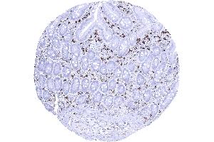 Immunohistochemistry (IHC) image for anti-Ionized Calcium-binding Adapter Molecule 1 (IBA1) (AA 1-146) antibody (ABIN7477371)