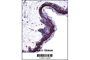 Immunohistochemistry (IHC) image for anti-Proteasome (Prosome, Macropain) Subunit, beta Type, 5 (PSMB5) (AA 235-263), (C-Term) antibody (ABIN5536411)