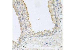 Immunohistochemistry of paraffin-embedded human prostate using ANKH antibody at dilution of 1:100 (x40 lens).