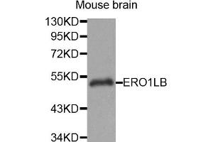 Western Blotting (WB) image for anti-ERO1-Like beta (ERO1LB) antibody (ABIN1875678) (ERO1LB Antikörper)