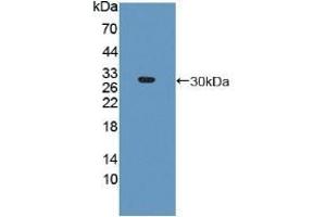 Detection of Recombinant PSMa5, Human using Polyclonal Antibody to Proteasome Subunit Alpha Type 5 (PSMa5) (PSMA5 Antikörper  (AA 1-241))