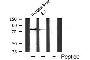 Western blot analysis of TIMP4 expression in NIH-3T3 whole cell lysates,The lane on the left is treated with the antigen-specific peptide.