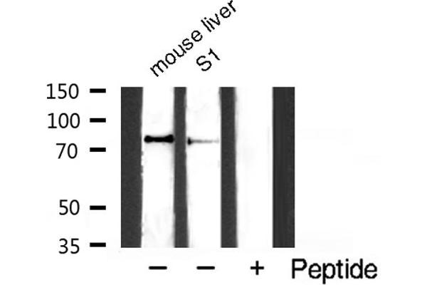 IKK alpha antibody  (pSer176, pSer177)